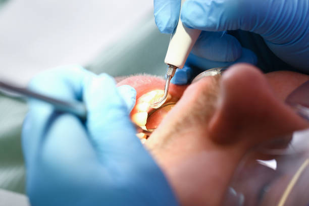 Best Emergency TMJ Treatment in Oxford, PA